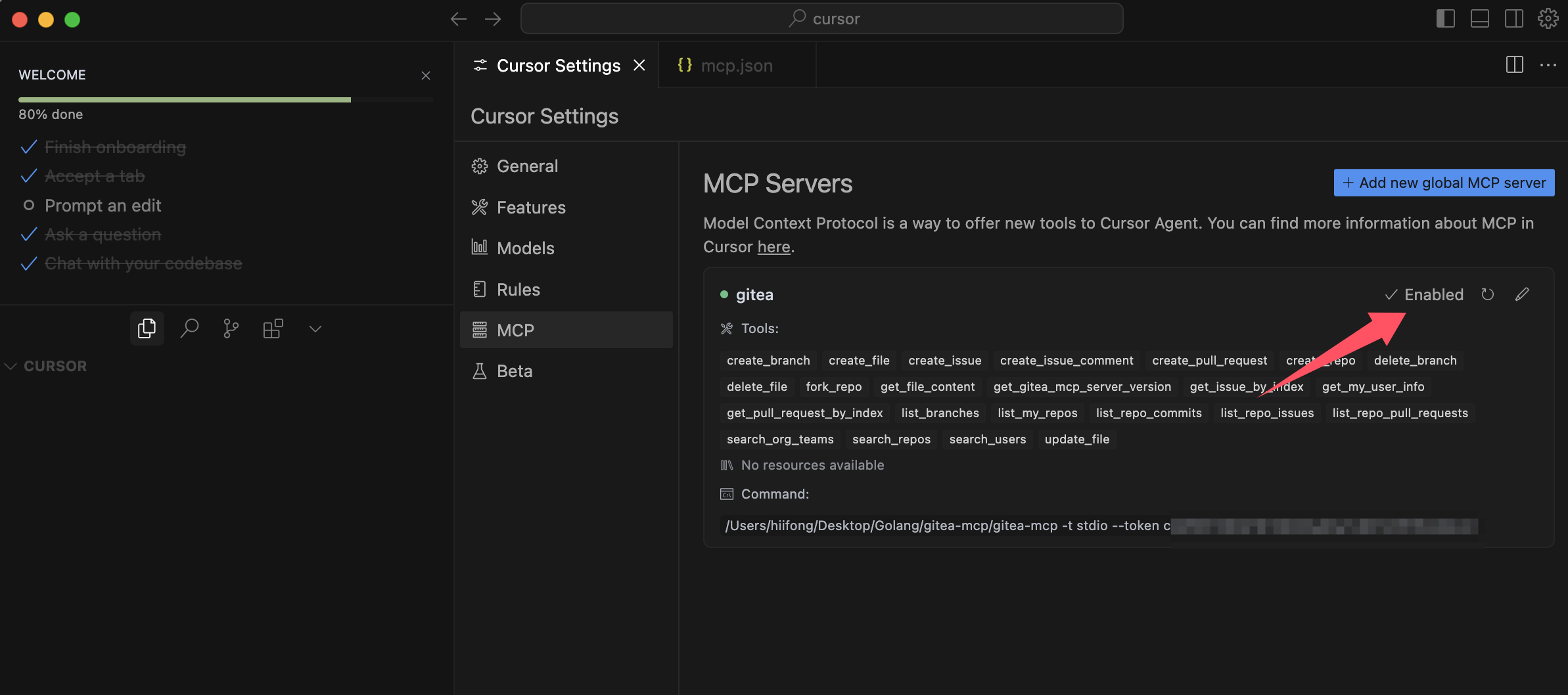 Settings Entry